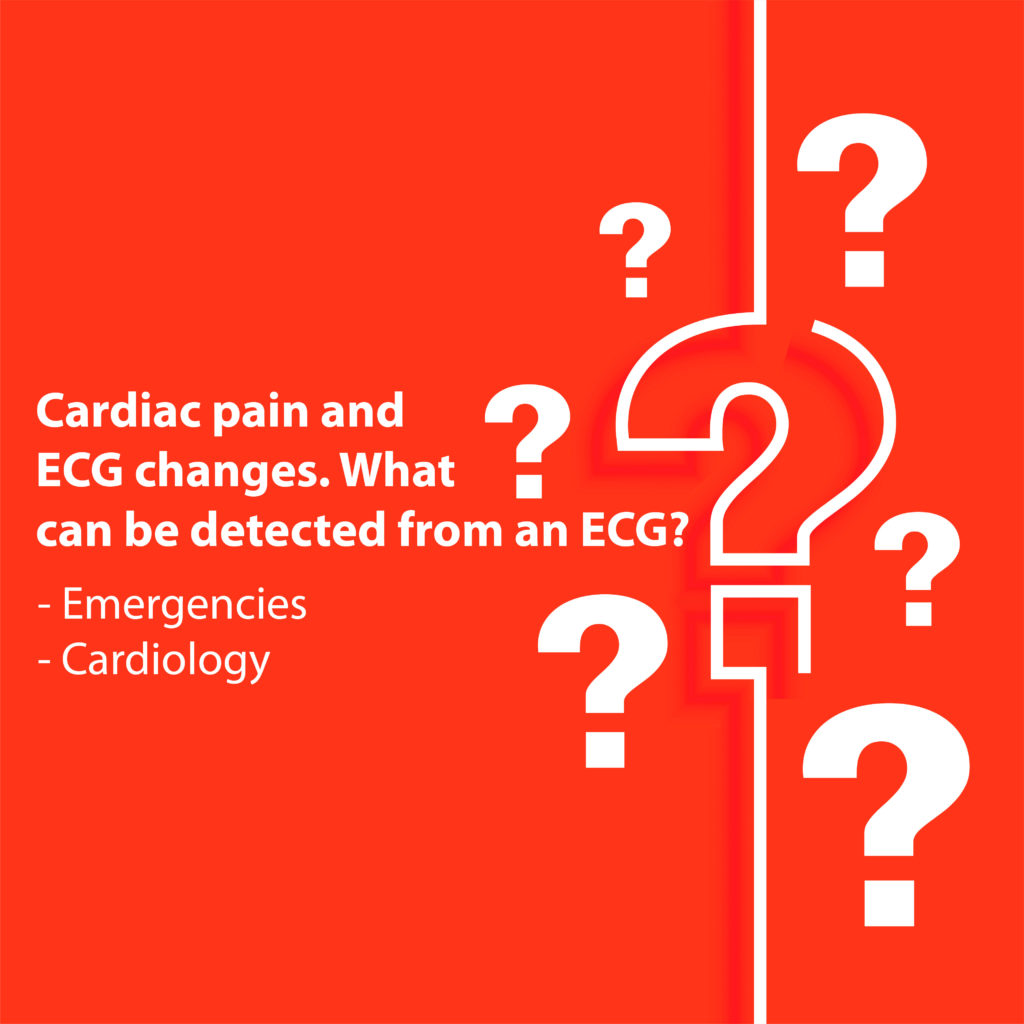 Cardiac pain and ECG changes. What can be detected from an ECG?